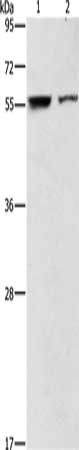 Gel: 8%SDS-PAGE, Lysate: 40 μg, Lane 1-2: Jurkat cells, 293T cells, Primary antibody: ARHGAP15 Antibody(ARHGAP15 Antibody) at dilution 1/500, Secondary antibody: Goat anti rabbit IgG at 1/8000 dilution, Exposure time: 2 minutesRabbit anti-Human ARHGAP15 Polyclonal Antibody