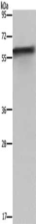 Gel: 8%SDS-PAGE, Lysate: 40 μg, Lane: Mouse liver tissue, Primary antibody: FKBP8 Antibody(FKBP8 Antibody) at dilution 1/1150, Secondary antibody: Goat anti rabbit IgG at 1/8000 dilution, Exposure time: 1 minuteRabbit anti-Human FKBP8 Polyclonal Antibody