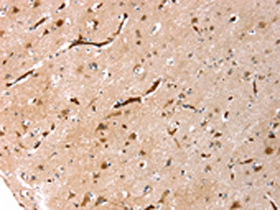 The image on the left is immunohistochemistry of paraffin-embedded Human brain tissue using AQP1 Antibody(AQP1 Antibody) at dilution 1/20, on the right is treated with synthetic peptide. (Original magnification: ×200)Rabbit anti-Human AQP1 Polyclonal Antibody