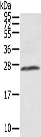 Gel: 12%SDS-PAGE,Lysate: 40 μg,,Primary antibody: AQP1 Antibody(AQP1 Antibody) at dilution 1/300 dilution,Secondary antibody: Goat anti rabbit IgG at 1/8000 dilution,Exposure time: 5 secondsRabbit anti-Human AQP1 Polyclonal Antibody