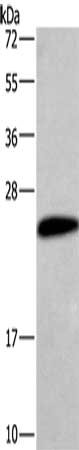 Gel: 10%SDS-PAGE, Lysate: 40 μg, Lane: Human placenta tissue, Primary antibody: CGB Antibody(CGB Antibody) at dilution 1/454, Secondary antibody: Goat anti rabbit IgG at 1/8000 dilution, Exposure time: 5 minutesRabbit anti-Human CGB Polyclonal Antibody