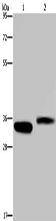 Gel: 10%SDS-PAGE, Lysate: 30 μg, Lane: Human fetal lung tissue, Primary antibody: CA4 Antibody(CA4 Antibody) at dilution 1/250, Secondary antibody: Goat anti rabbit IgG at 1/8000 dilution, Exposure time: 40 seconds