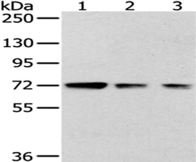 Gel: 6%SDS-PAGE, Lysate: 40 μg, Lane 1-3: 293T, hela and A172 cell, Primary antibody: HNRNPM Antibody(HNRNPM Antibody) at dilution 1/400 dilution, Secondary antibody: Goat anti rabbit IgG at 1/8000 dilution, Exposure time: 1 minuteRabbit anti-Human HNRNPM Polyclonal Antibody