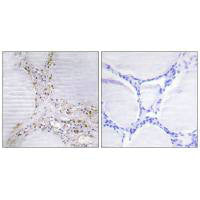 Immunohistochemistry analysis of paraffin-embedded human thyroid gland tissue using BMX antibody.
