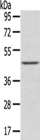 Gel: 8%SDS-PAGE,Lysate: 40 μg,,Primary antibody: LEFTY2 Antibody(LEFTY2 Antibody) at dilution 1/800 dilution,Secondary antibody: Goat anti rabbit IgG at 1/8000 dilution,Exposure time: 30 seconds