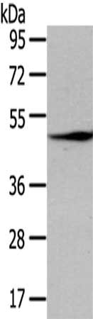 Gel: 8%SDS-PAGE,Lysate: 40 μg,,Primary antibody: LEFTY2 Antibody(LEFTY2 Antibody) at dilution 1/200 dilution,Secondary antibody: Goat anti rabbit IgG at 1/8000 dilution,Exposure time: 30 seconds