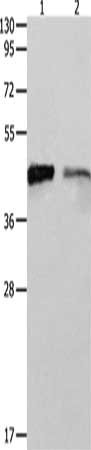 Gel: 10%SDS-PAGE, Lysate: 40 μg, Lane 1-2: 293T cells, A549 cells, Primary antibody: LRPAP1 Antibody(LRPAP1 Antibody) at dilution 1/1400, Secondary antibody: Goat anti rabbit IgG at 1/8000 dilution, Exposure time: 1 minute