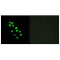 Immunofluorescence analysis of HepG2 cells, using IRX2 antibody.