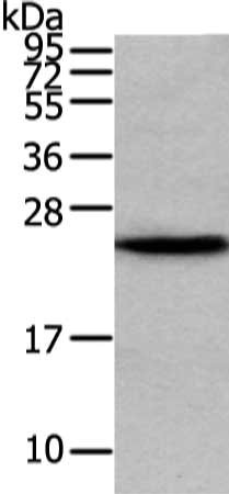 Gel: 12%SDS-PAGE, Lysate: 40 μg, Lane: Human fetal liver tissue, Primary antibody: VPS28 Antibody(VPS28 Antibody) at dilution 1/200 dilution, Secondary antibody: Goat anti rabbit IgG at 1/8000 dilution, Exposure time: 5 secondsRabbit anti-Human VPS28 Polyclonal Antibody