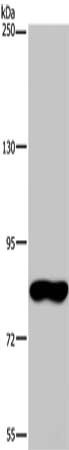 Gel: 6%SDS-PAGE, Lysate: 40 μg, Lane: Hela cells, Primary antibody: FAF1 Antibody(FAF1 Antibody) at dilution 1/400, Secondary antibody: Goat anti rabbit IgG at 1/8000 dilution, Exposure time: 5 minutesRabbit anti-Human FAF1 Polyclonal Antibody