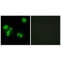 Immunofluorescence analysis of A549 cells, using TFIP8 antibody.Rabbit anti-Human TNFAIP8 Polyclonal Antibody