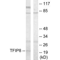 Western blot analysis of extracts from HUVEC cells, using TFIP8 antibody.Rabbit anti-Human TNFAIP8 Polyclonal Antibody