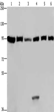Gel: 6%SDS-PAGE, Lysate: 40 μg, Lane 1-6: LoVo cells, HepG2 cells, NIH/3T3 cells, MCF7 cells, 293T cells, Hela cells, Primary antibody: EEF2 Antibody(EEF2 Antibody) at dilution 1/200, Secondary antibody: Goat anti rabbit IgG at 1/8000 dilution, Exposure time: 20 secondsRabbit anti-Human EEF2 Polyclonal Antibody