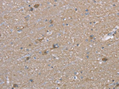 The image on the left is immunohistochemistry of paraffin-embedded Human brain  tissue using MAPRE3 Antibody(MAPRE3 Antibody) at dilution 1/20, on the right is treated with fusion protein. (Original magnification: ×200)