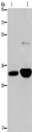 Gel: 8%SDS-PAGE, Lysate: 40 μg, Lane 1-2: Human fetal brain tissue, mouse brain tissue, Primary antibody: MAPRE3 Antibody(MAPRE3 Antibody) at dilution 1/500, Secondary antibody: Goat anti rabbit IgG at 1/8000 dilution, Exposure time: 30 seconds