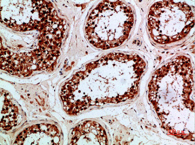 Immunohistochemical analysis of paraffin-embedded human-testis, antibody was diluted at 1:200Rabbit anti-Human PENK Polyclonal Antibody