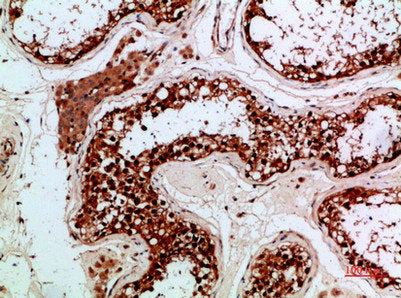 Immunohistochemical analysis of paraffin-embedded human-testis, antibody was diluted at 1:200Rabbit anti-Human PENK Polyclonal Antibody