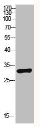 Western Blot analysis of NT28 cells using Antibody diluted at 1000. Secondary antibody  was diluted at 1:20000Rabbit anti-Human PENK Polyclonal Antibody