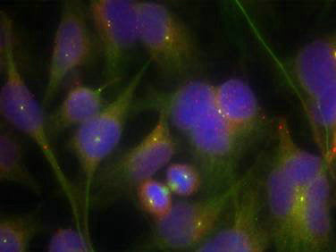 Immunofluorescence staining of methanol-fixed Hela cells using FAK(Ab-925) Antibody.Rabbit anti-Human PTK2 Polyclonal Antibody