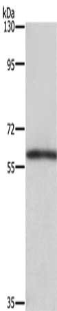 Gel: 8%SDS-PAGE, Lysate: 40 μg, Lane: Mouse kidney tissue, Primary antibody: TBX5 Antibody(TBX5 Antibody) at dilution 1/350, Secondary antibody: Goat anti rabbit IgG at 1/8000 dilution, Exposure time: 3 minutesRabbit anti-Human TBX5 Polyclonal Antibody