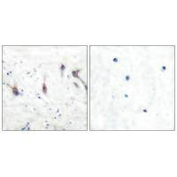 Immunohistochemical analysis of paraffin-embedded human brain tissue using ARC antibody.Rabbit anti-Human ARC Polyclonal Antibody