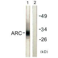 Western blot analysis of extracts from HeLa cells, using ARC antibody.Rabbit anti-Human ARC Polyclonal Antibody