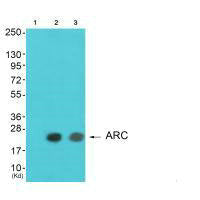Western blot analysis of extracts from HeLa cells and A549 cells using ARC antibody. The lane on the left is treated with synthesized peptide.Rabbit anti-Human ARC Polyclonal Antibody