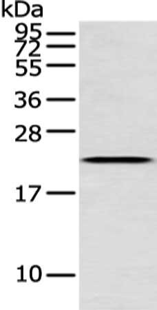 Gel: 12%SDS-PAGE, Lysate: 40μg, Lane: Human fetal liver tissue, Primary antibody: IFNG Antibody(IFNG Antibody) at dilution 1/250 dilution, Secondary antibody: Goat anti rabbit IgG at 1/8000 dilution, Exposure time: 1 minuteRabbit anti-Human IFNG Polyclonal Antibody