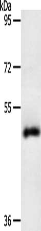 Gel: 10%SDS-PAGE, Lysate: 40 μg, Lane: Human liver cancer tissue, Primary antibody: SPATA17 Antibody(SPATA17 Antibody) at dilution 1/200, Secondary antibody: Goat anti rabbit IgG at 1/8000 dilution, Exposure time: 10 minutesRabbit anti-Human SPATA17 Polyclonal Antibody
