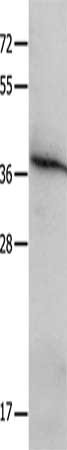 Gel: 10%SDS-PAGE, Lysate: 40 μg, Lane: K562 cells, Primary antibody: MYD88 Antibody(MYD88 Antibody) at dilution 1/300, Secondary antibody: Goat anti rabbit IgG at 1/8000 dilution, Exposure time: 2 secondsRabbit anti-Human MYD88 Polyclonal Antibody