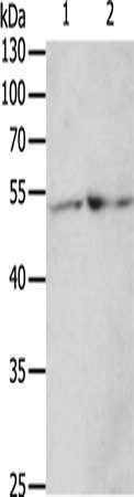Gel: 10%SDS-PAGE, Lysate: 50 μg, Lane 1-2: 293T cells, hela cells, Primary antibody: TERF1 Antibody(TERF1 Antibody) at dilution 1/200, Secondary antibody: Goat anti rabbit IgG at 1/8000 dilution, Exposure time: 5 minutesRabbit anti-Human TERF1 Polyclonal Antibody
