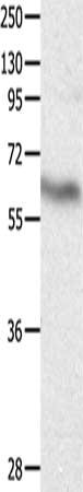 Gel: 8%SDS-PAGE, Lysate: 30 μg, Lane: Human fetal brain tissue, Primary antibody: DPYSL4 Antibody(DPYSL4 Antibody) at dilution 1/500, Secondary antibody: Goat anti rabbit IgG at 1/8000 dilution, Exposure time: 20 secondsRabbit anti-Human DPYSL4 Polyclonal Antibody