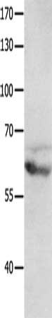 Gel: 8%SDS-PAGE, Lysate: 40 μg, Lane: Mouse brain tissue, Primary antibody: GRM8 Antibody(GRM8 Antibody) at dilution 1/1200, Secondary antibody: Goat anti rabbit IgG at 1/8000 dilution, Exposure time: 5 minutesRabbit anti-Human GRM8 Polyclonal Antibody