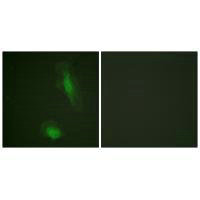 Immunofluorescence analysis of HeLa cells, using Akt (Ab-129) antibody.Rabbit anti-Human AKT1 Polyclonal Antibody