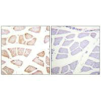 Immunohistochemistry analysis of paraffin-embedded human skeletal muscle tissue using Akt (Ab-129) antibody.Rabbit anti-Human AKT1 Polyclonal Antibody