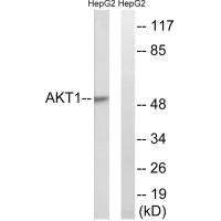 Western blot analysis of extracts from HuvEc cells, treated with Serum (30%, 30mins), using Akt (Ab-129) antibody.Rabbit anti-Human AKT1 Polyclonal Antibody
