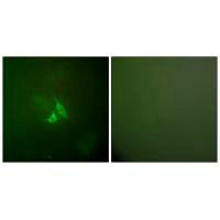 Immunofluorescence analysis of A549 cells, using Cox2 antibody.Rabbit anti-Human PTGS2 Polyclonal Antibody