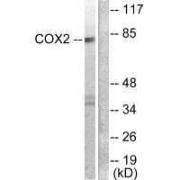 Western blot analysis of extracts from A549 cells, using Cox2 antibody.Rabbit anti-Human PTGS2 Polyclonal Antibody