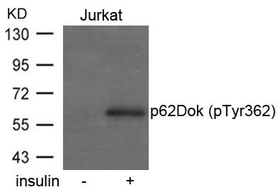 Western blot analysis of extracts from Jurkat cells untreated or treated with insulin using p62Dok(phospho-Tyr362) Antibody.Rabbit anti-Human DOK1 Polyclonal Antibody
