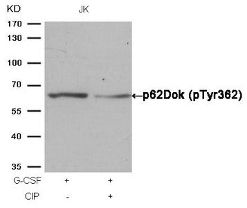 Western blot analysis of extracts from JK cells, treated with G-CSF or calf intestinal phosphatase (CIP), using p62Dok (phospho-Tyr362) Antibody.Rabbit anti-Human DOK1 Polyclonal Antibody
