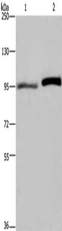 Gel: 6%SDS-PAGE, Lysate: 40 μg, Lane 1-2: LoVo cells, Hela cells, Primary antibody: ELAC2 Antibody(ELAC2 Antibody) at dilution 1/250, Secondary antibody: Goat anti rabbit IgG at 1/8000 dilution, Exposure time: 1 minuteRabbit anti-Human ELAC2 Polyclonal Antibody