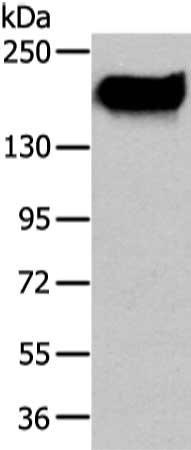 Gel: 6%SDS-PAGE, Lysate: 40 μg, Lane: A431 cell, Primary antibody: ABCC1 Antibody(ABCC1 Antibody) at dilution 1/350 dilution, Secondary antibody: Goat anti rabbit IgG at 1/8000 dilution, Exposure time: 1 minute