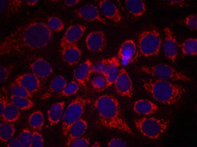 Immunofluorescence staining of methanol-fixed MCF7 cells using HER2(Phospho-Tyr1248) Antibody.Rabbit anti-Human ERBB2 Polyclonal Antibody