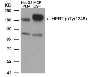 Western blot analysis of extracts from HepG2 cells treated with PMA and MCF cells treated with EGF, using HER2 (Phospho-Tyr1248) Antibody.Rabbit anti-Human ERBB2 Polyclonal Antibody