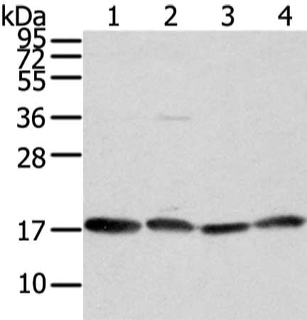 Gel: 12%SDS-PAGE, Lysate: 40 μg, Lane 1-4: K562, hela, TM4 and PC3 cell, Primary antibody: VAMP4 Antibody(VAMP4 Antibody) at dilution 1/800 dilution, Secondary antibody: Goat anti rabbit IgG at 1/8000 dilution, Exposure time: 10 secondsRabbit anti-Human VAMP4 Polyclonal Antibody