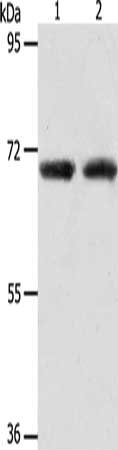 Gel: 8%SDS-PAGE, Lysate: 40 μg, Lane 1-2: Human liver cancer tissue, Human fetal kidney tissue, Primary antibody: ACOT11 Antibody(ACOT11 Antibody) at dilution 1/650, Secondary antibody: Goat anti rabbit IgG at 1/8000 dilution, Exposure time: 90 seconds