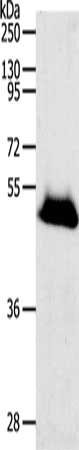 Gel: 10%SDS-PAGE, Lysate: 40 μg, Lane: Human liver cancer tissue, Primary antibody: RBMS3 Antibody(RBMS3 Antibody) at dilution 1/1000, Secondary antibody: Goat anti rabbit IgG at 1/8000 dilution, Exposure time: 20 secondsRabbit anti-Human RBMS3 Polyclonal Antibody