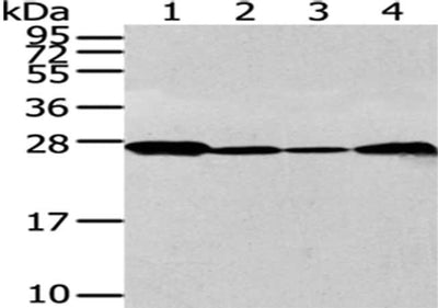 Gel: 12%SDS-PAGE, Lysate: 40 μg, Lane 1-4: 293T, K562, Jurkat and 231 cell, Primary antibody: UCHL3 Antibody(UCHL3 Antibody) at dilution 1/300 dilution, Secondary antibody: Goat anti rabbit IgG at 1/8000 dilution, Exposure time: 30 secondsRabbit anti-Human UCHL3 Polyclonal Antibody