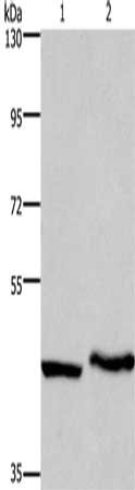 Gel: 8%SDS-PAGE, Lysate: 40 μg, Lane 1-2: Human placenta tissue, Human testis tissue, Primary antibody: MCHR1 Antibody(MCHR1 Antibody) at dilution 1/300, Secondary antibody: Goat anti rabbit IgG at 1/8000 dilution, Exposure time: 2 minutes