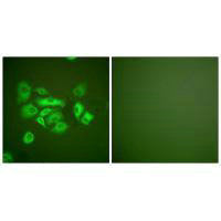 Immunofluorescence analysis of A549 cells, using Keratin 10 antibody.
